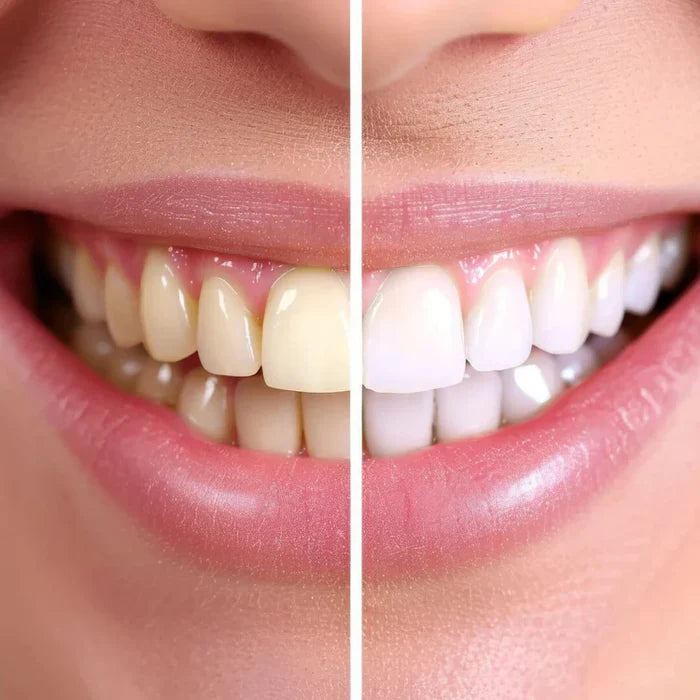 OliSmile™ - Brosse à dents 360° intelligente