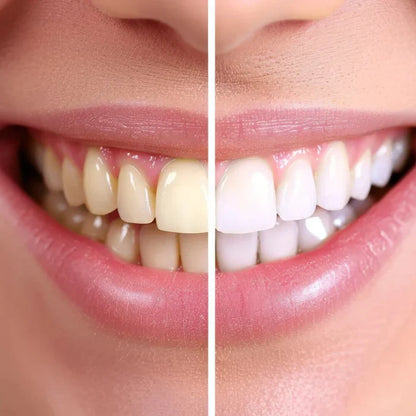 OliSmile™ - Brosse à dents 360° intelligente